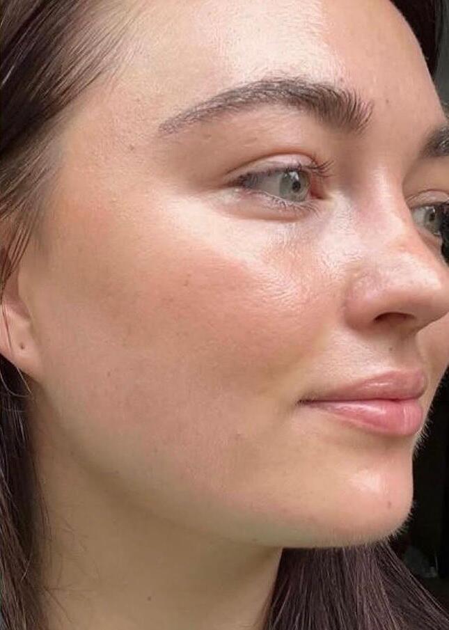 Treatment result after procedure